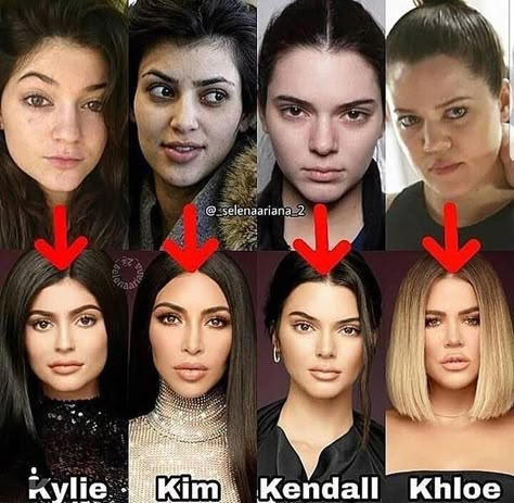 Wonder Girls, Facial Aesthetics, Makeup News, Makeup For Blondes, Power Of Makeup, Mosquito Bite, Without Makeup, Kardashian Jenner, Girls Makeup