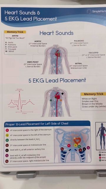 12 Lead Ekg Placement Nursing Students, Ekg Notes, 12 Lead Ekg Placement, Simple Nursing Study Guides, Ekg Placement, Emt Basic, Simple Nursing, Nursing Skills, Medical Assistant Student