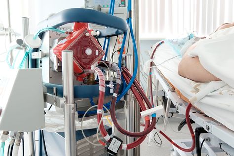 Ecmo Machine, Life Support Machine, Doctors Note, Heart And Lungs, Medical News, Critical Care, School Of Medicine, Medical Equipment, Lungs