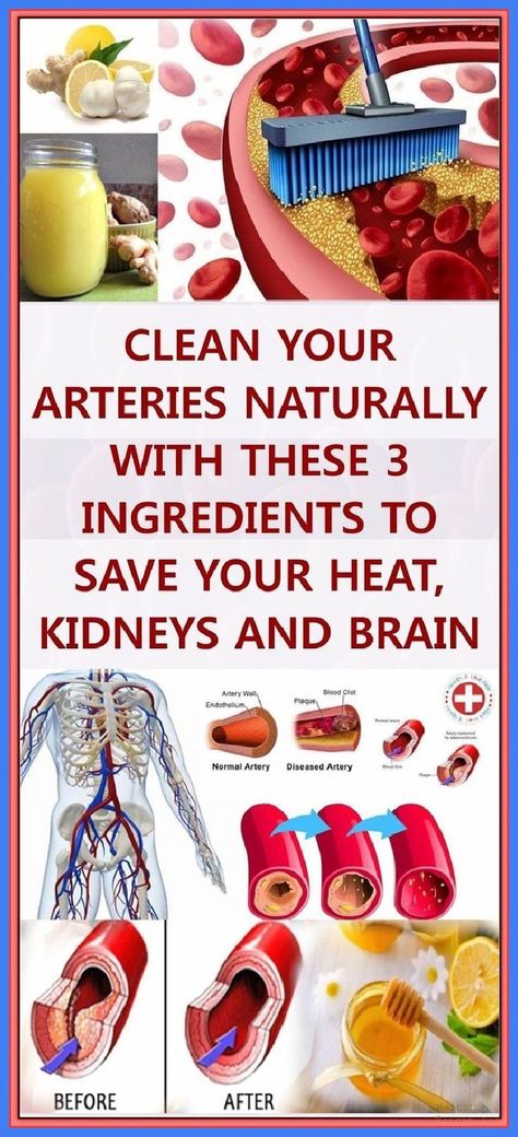 With This Secret Remedy Clean Your Arteries, Lower Cholesterol And Strengthens Your Immune Syst Brain Pin, Clean Arteries, Body Cleansing, Vintage Stereo, Chic Gowns, Ldl Cholesterol, Homemade Remedies, Led Lamps, High Cholesterol