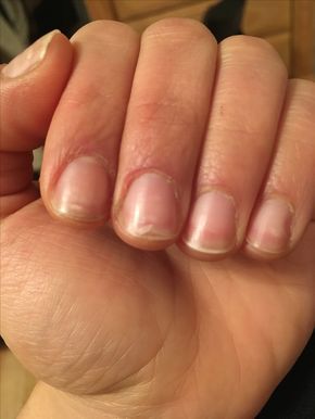 Do you suffer from weak and peeling nails? If so try out this easy DIY nail strengthener using all natural ingredients and essential oils. Split Nails, Nail Remedies, Nail Growth Tips, Peeling Nails, Grow Nails Faster, Food Nails, Weak Nails, Damaged Nails, Nail Care Routine