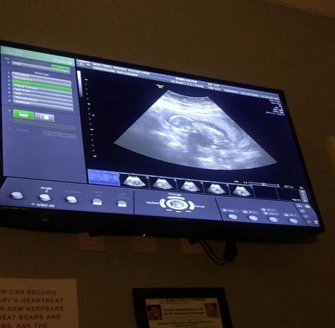 Fake Ultrasound Pictures 2023, 8 Weeks Pregnant Ultrasound, 7 Weeks Pregnant Ultrasound, 5 Weeks Pregnant Ultrasound, Boy Ultrasound Pictures, Ultrasound Video, Boy Ultrasound, Fake Ultrasound, Baby Ultrasound Pictures