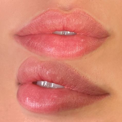 Medium Size Lips, Soft Lip Filler, Natural Lip Blushing, Keyhole Pout Lips, Lip Filler Natural Look, Natural Lips Aesthetic, Lip Filler Inspiration 1ml, Pout Lip Filler, Perfect Lips Aesthetic