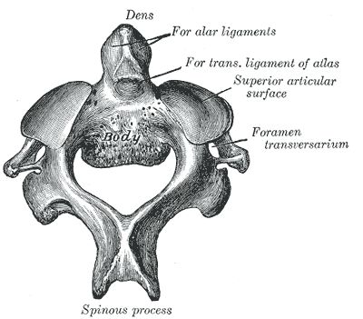 Axis Vertebra, Sternocleidomastoid Muscle, Anatomy Images, Forward Head Posture, Cervical Vertebrae, Nurse Art, Tempe Az, Trouble Sleeping, Anatomy Drawing