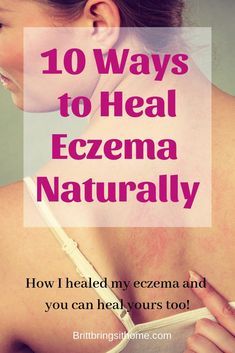 How I healed my eczema and 10 tips for you to heal your eczema naturally from the inside out! via @Britt Brings It Home Itchy Skin Remedy, Atopic Skin, Dry Skin Care, Skin Remedies, Skin Tips, Doterra, Skin Health, Clear Skin, Dry Skin