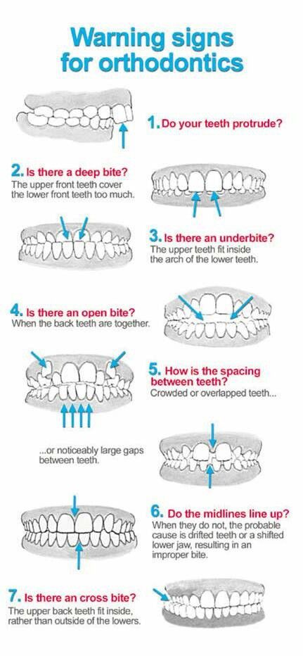 DISCOVER DENTISTS® Warning Signs for Orthodontics http://DiscoverDentists.com Benefits Of Dental Implants, Dentist Memes Humor Funny, Dental Memes Humor, Dental World, Orthodontics Memes, Dental Anatomy, Dental Hygiene School, Dental Braces, Restorative Dentistry