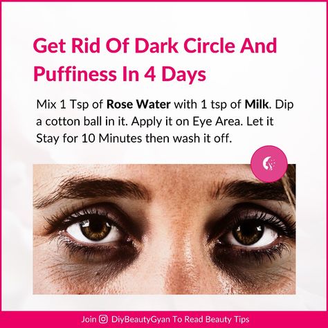 Rose Water + Milk Unwanted Facial Hair, Glossy Makeup, Remove Dark Circles, Pink Cheeks, Dark Circle, Diy Hair Care, For Eyes, Workout Pictures, Cotton Ball