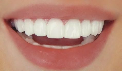 Teeth Aesthetic, Pretty Teeth, Studera Motivation, Perfect Teeth, Dream Vision Board, روتين العناية بالبشرة, Vision Board Manifestation, Life Vision Board, Beauty Goals