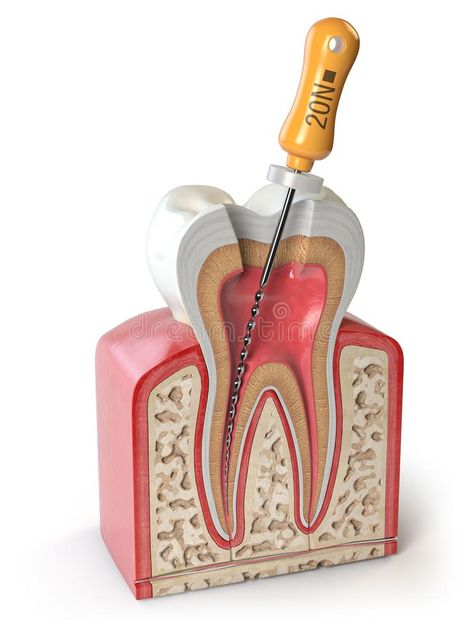 Cross section of Human tooth with endodontic file isolated on white vector illustration Church Website Design, Dental Pictures, Cosmetic Web, Dental Posters, Batman Gifts, Dental Photography, Dental Anatomy, Human Teeth, Dental Art