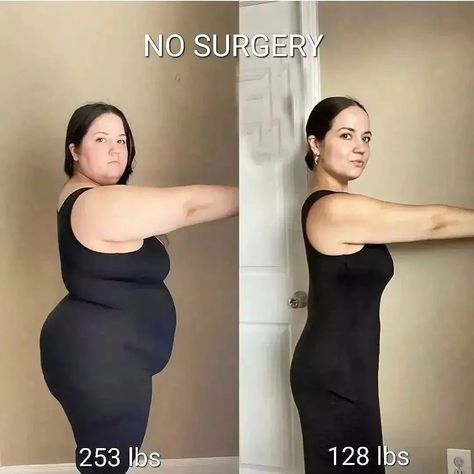 Before and after weight loss transformation. easy ways to lost weight for women | easy ways to loss belly fat fast | easy ways to loss weight for women past | easy ways to loss weight lazy girl | easy ways to lost weight in a week #lossweight #skinny #lossbellyfat howtolossweight #fitness #weightloss#weightlosstips Weights For Women, Fitness Inspiration Body, Fat To Fit, Fitness Transformation, Transformation Body, Belly Fat, Pug, Matcha, Rolls