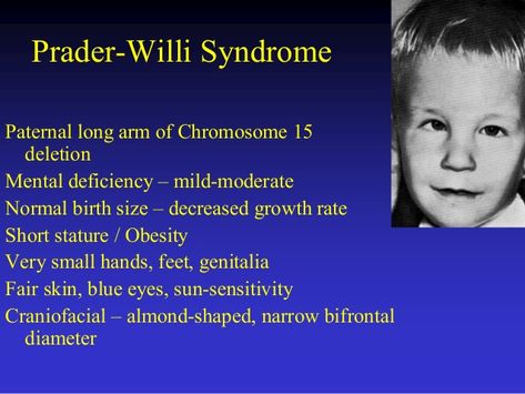 prader willi syndrome eyes | Implantation of embryo 3 Prader Willi Syndrome, Normal Birth, Medical Mnemonics, Fair Skin, Blue Eyes, Medical, For Free, Skin, Memes