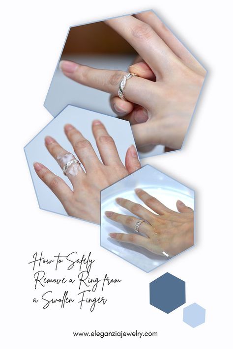 Whether it’s from weight gain, an injury, or due to pregnancy, a stuck ring band is no fun for anyone. Learn how to safely remove a ring from a swollen finger with Eleganzia Jewelry. How To Remove Ring From Swollen Finger, How To Get A Ring Off A Swollen Finger, Sleight Of Hand, How To Clean Silver, Helpful Things, Dating Tips For Women, Deep Tissue, Lubricant, Massage Therapy