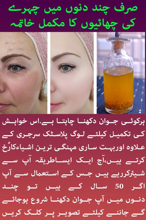 Wrinkle Remedies Face, Face Wrinkles Remover, Face Wrinkles Remedies, Face Wrinkle, Wrinkles Remedies, Wrinkles Remedies Face, Summer Beauty Tips, Wrinkle Remedies, Home Remedies For Skin