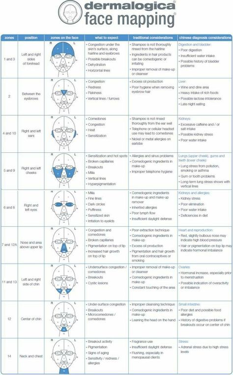 Doterra Acne, Gesicht Mapping, Face Map, Face Mapping Acne, Face Mapping, Acne Causes, Her Campus, Beauty Therapy, Face Acne