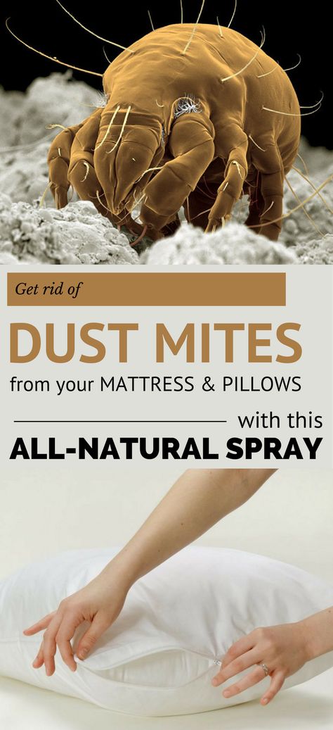 'Get Rid of Dust Mites From Your Mattress and Pillows With This All-Natural Spray - 101CleaningTips.net...!' (via 101CleaningTips.net - Find free tips for your home) Dust Allergy Symptoms, Dust Mite Spray, Mattress Spray, Dust Mite Allergy, Mattress Cleaner, Dust Allergy, Insect Spray, Natural Mattress, Mattress Cleaning