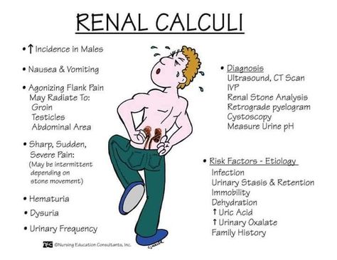 Kidney stones Gastrointestinal Nursing, Renal Calculi, Emt Study, Physician Assistant School, Medical Terminology Study, Medical Mnemonics, Nursing Board, Nursing Study Guide, Nursing School Motivation