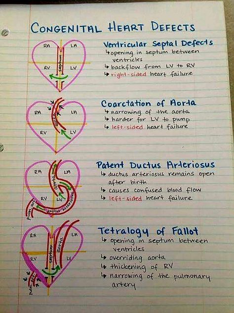 Congenital Heart Defects Nursing Student Tips, Congenital Heart Defect, Cardiac Nursing, Heart Defect, Nursing School Survival, Congenital Heart, Best Nursing Schools, Nursing School Studying, Nursing School Tips