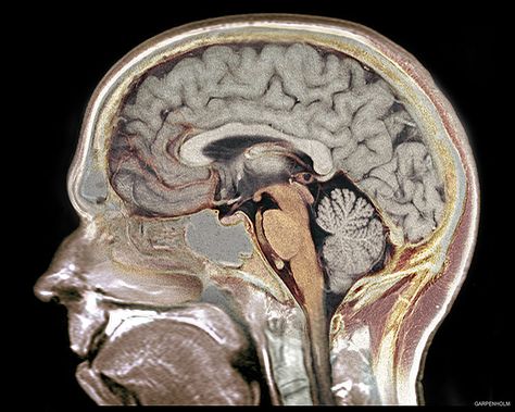 Nice side view of the human brain Brain Size, Non Human, Human Brain, Anatomy And Physiology, Neurology, Radiology, Human Anatomy, Alzheimers, Brain Health