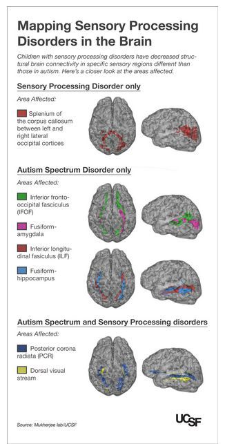 Coming To My Senses: Sensory Processing Disorder, Plain and Simple Sensory Disorder, Sensory Diet, Pediatric Occupational Therapy, Processing Disorder, Sensory Integration, Sensory Issues, Counseling Resources, Learning Methods, Sensory Processing Disorder