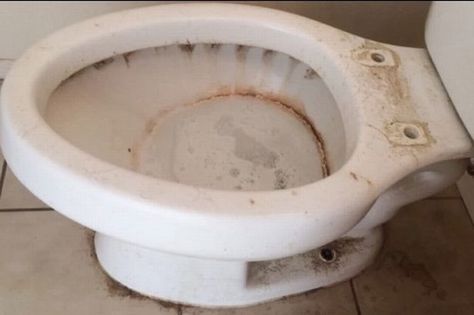 Cleaner shares hack to remove tough toilet stains after 'gross' transformation job - Mirror Online How To Remove Black Stains From Toilet, Gross Toilet, Toilet Stains, Pumice Stones, Move Out Cleaning, House Shed, Professional Cleaners, Pad Design, Black Stains