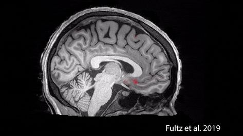 Spinal Fluid, Reaction Gif, Cerebrospinal Fluid, Brain Activities, Brain Waves, Sleep Pattern, Human Brain, What Happened To You, Neuroscience