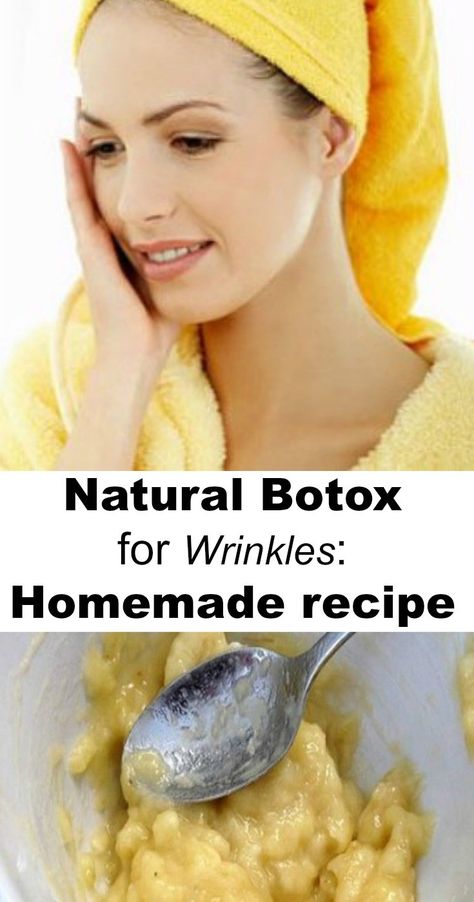 Botox For Wrinkles, Botox Wrinkles, Do It Yourself Nails, Natural Botox, Homemade Moisturizer, Wrinkle Free Skin, Homemade Recipe, Homemade Face Masks, Anti Aging Tips