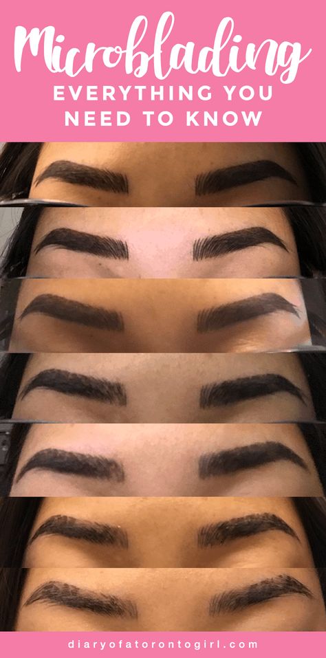 Microblading Healing Process, Mircoblading Eyebrows, Microblading Aftercare, Eyebrow Before And After, Canadian Lifestyle, Ombre Eyebrows, Semi Permanent Eyebrows, Was It Worth It, Eyebrow Microblading