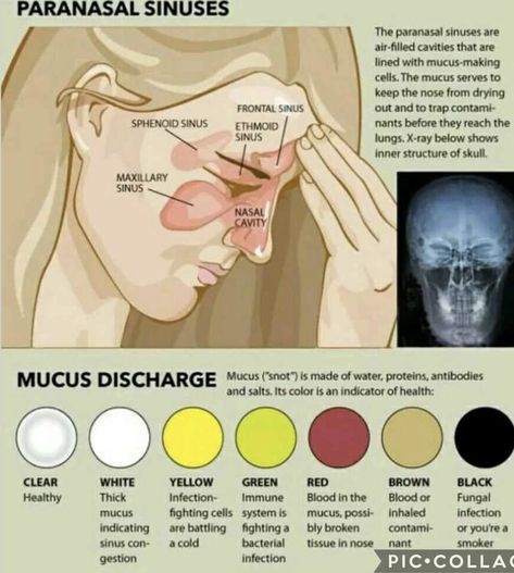 Mucus Color Chart, Mucus Color, Cleansing Herbs, Paranasal Sinuses, Sinus Health, Maxillary Sinus, Sinus Cavities, Medical Memes, Ear Anatomy