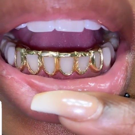 Grills Black Women Aesthetic, Grills On Black Women, Womens Grillz, Grillz For Females Aesthetic, Black Girls With Grills, Gold Grill Women, Silver Grillz For Females, Cute Grills For Women, Girly Grillz