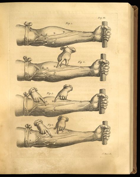 have difficulty drawing blood  4 needles is a lot Medical Reception, Medical Diagrams, Anatomical Illustration, William Harvey, Assistant Nurse, Scientific Art, Certified Medical Assistant, Scientific Revolution, Magna Carta