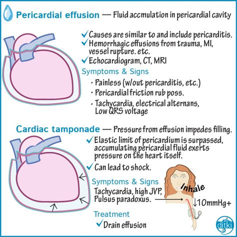 Preview of our upcoming tutorial on Pericardial Diseases!  Click the link in our bio to find clickable images that take you to the flashcards or tutorials! On our site, you can also demo other full-length tutorials, as well as our quiz questions and an interactive drawing pad with starter images and labels!  #medstudy #medschool #medstudent #medicalschool #medicalstudent #mcat #mcatstudying #comlex #usmlestep1 #usmle #usmleprep #usmleworld #studymedicine #firstaidusmlestep1 #firstaidmednotes #me Pathophysiology Nursing, Pericardial Effusion, Doctor Of Nursing Practice, Medical Mnemonics, Diagnostic Medical Sonography, Cardiac Disease, Nursing School Essential, Nurse Study Notes, Medical Surgical Nursing