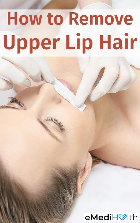 Removing upper lip hair at home is a common practice and can be performed in various ways. Always conduct a patch test before trying a new method of removing upper lip hair. Here are some common hair removal methods that you can try at home. Remove Upper Lip Hair, Waxing Vs Shaving, Natural Hair Removal Remedies, Upper Lip Hair Removal, Hair Removal At Home, Lip Hair Removal, Upper Lip Hair, At Home Hair Removal, Hair Removal Methods