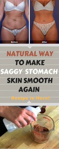 Tighten Loose Belly Skin, Skin Firming Lotion, Tighten Stomach, Skin Tightening Stomach, Loose Belly, Tighten Loose Skin, Healthy Wraps, Skin Bumps, Saggy Skin