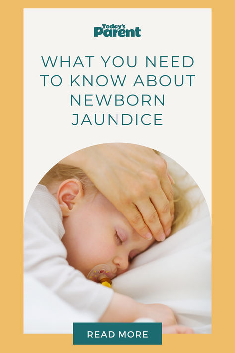 sick newborn with jaundice Baby Jaundice, Newborn Care, Kids Health, Home Remedies, Need To Know, Parenting, Health