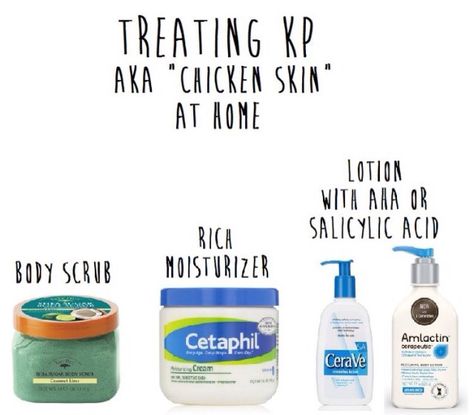 Keratosis Pilaris Remedy, Keratosis Pilaris, Bumpy Skin, Body Acne, Chicken Skin, Beauty Remedies, Beauty Tips For Skin, Skin Remedies, How To Get Rid Of Acne