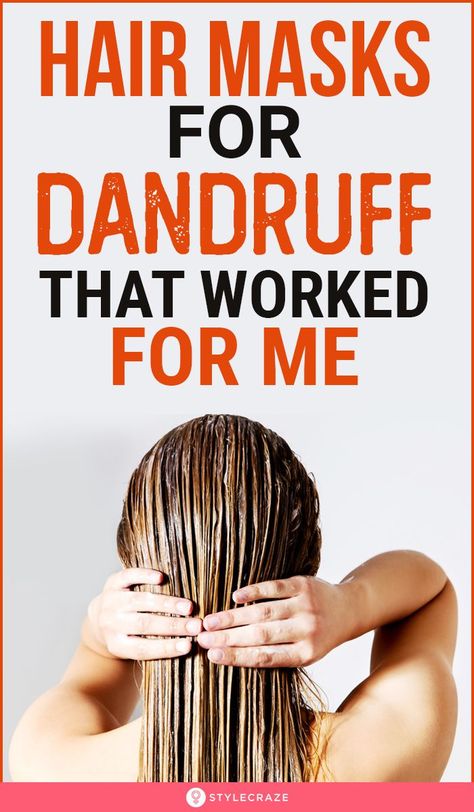 Scalp Mask For Dandruff, How To Deal With Dandruff, Hairmask Diy Dandruff, Curd Hair Mask For Dandruff, How To Get Rid Of Dandruff Fast At Home, Dandruff Remedy Diy, How To Get Rid Of Dandruff, Hair Masks For Dandruff, Home Remedy For Dandruff