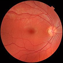 Definition of Retina Anatomy Lessons, Vision Health, Gene Therapy, Light Sensitivity, Vision Loss, Nerve Cell, Eyes Problems, Light Rays, Body Organs