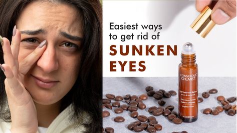 Easiest ways to get rid of sunken eyes Sunken Cheeks, Eyeshadow For Sunken Eyes, How To Get Rid Of Sunken Under Eyes, Eye Makeup For Sunken Eyes, Dark Sunken Under Eyes, Sunken Eyes, Keratosis Pilaris, Tranexamic Acid, Kojic Acid