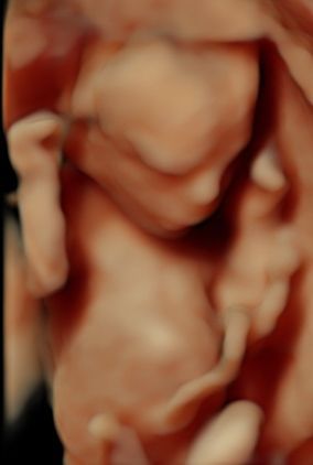 3d Images With Precious Previews Australia 3d Ultrasound, 3d Images, 16 Weeks, Ultrasound, Reveal Parties, Gender Reveal Party, Gender Reveal, Brisbane, Family Friends