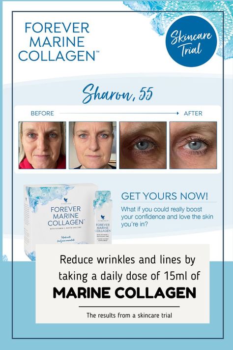 The results for a 30-day skincare trial using Foever Marine Collagen are clear for everyone to see: 100% said their skin was more hydrated and supple 89% said they looked less tired 78% said their skin was brighter, more glowing 78% said they looked younger Comes in 15ml sachets, 30/box (1 month supply). 60-days money back guarantee on all purchases (no quibbles) – so go ahead and buy two packs! Buy your collagen here https://thealoeveraco.shop/ziXBI8JZ Forever Products, Forever Business, Skin Collagen, Collagen Supplements, Skin Hydration, Marine Collagen, Forever Living Products, Green Tea Extract, Goji Berries