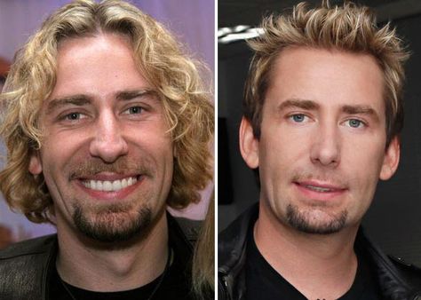 Chad Kroeger Plastic Surgery Before & After - http://plasticsurgerytalks.com/chad-kroeger-plastic-surgery/ Chad Kroeger Nickelback, Plastic Surgery Video, Bad Plastic Surgeries, Nose Jobs, Chad Kroeger, Popular Bands, Bruce Jenner, Male Celebs, Mommy Makeover