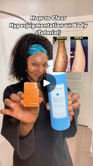 33K views · 525 reactions | Don’t forget sun protection☀️  1. Beginner Routine  ▪️Exfoliating Body Wash (Pictured @naturiumskin Mandelic Acid Body Wash) & A Brightening Body Lotion (Pictured @beyondpigment Brightening Kojic Acid Lotion).  Or  ▪️Kojic Acid Soap (Pictured: Kojie San Kojic Acid Soap) & An Exfoliating Body Lotion(Pictured @alphaskincare Renewal Body Lotion).  2. Advanced Routine  ▪️Tret + Hydroquinone + A Brightening Body Lotion (pictured @beyondpigment Brightening Kojic Acid Lotion).  -  #bodyhyperpigmentation #darkspotsonbody #kojicacid #glycolicacid #tretinoin #hydroquinone #hyperpigmentationsolution #hyperpigmentationproducts | RitaspeaksSkin | RitaspeaksSkin · Original audio Kojie San Soap Before And After, Clearing Hyperpigmentation, Brightening Body Lotion, Kojie San, Kojic Acid Soap, Exfoliating Body Wash, Body Tutorial, Acid Base, Mandelic Acid