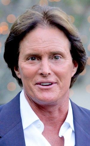 Bruce Jenner Before and after Photos Caitlyn Jenner Before And After, Hairstyle Names, Bruce Jenner, Jenner Family, Caitlyn Jenner, Cosmetic Procedures, Bruce Wayne, After Photos, Kardashian Jenner