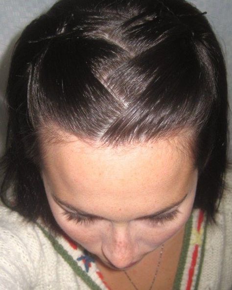 Zig Zag Parting Hairstyles, Zig Zag Hairstyle, Zig Zag Part Hair, Zig Zag Part, Skill To Learn, 2000s Hairstyles, Funky Hairstyles, Cut My Hair, Hair Inspo Color