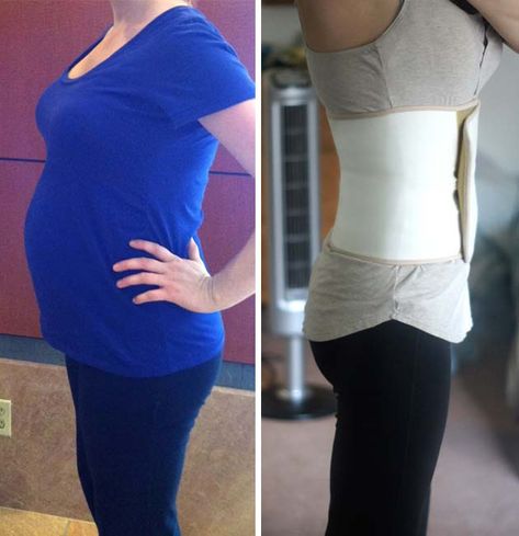 before and after Belly Bandit Before And After, Megan Ward, Post Partum Belly Wrap, Body After Baby, Belly Wrap, Postpartum Belly, Post Baby Body, Belly Bandit, Baby Prep