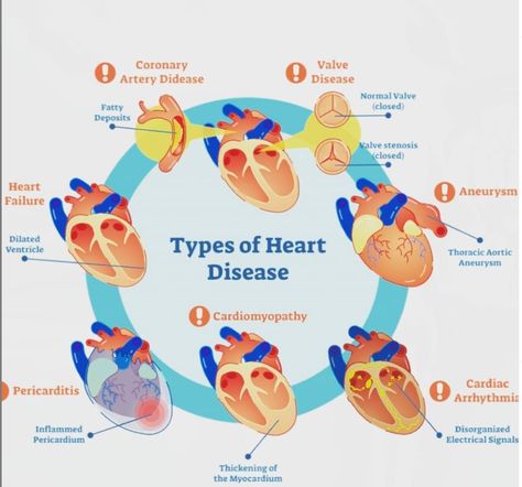 Learn more about cardiology by expert cardiologist - Dr Boon Lim Types Of Heart, Low Magnesium, Penyakit Jantung, Cardiac Nursing, Heart Muscle, Coronary Arteries, Medical Imaging, Cardiology, Nclex