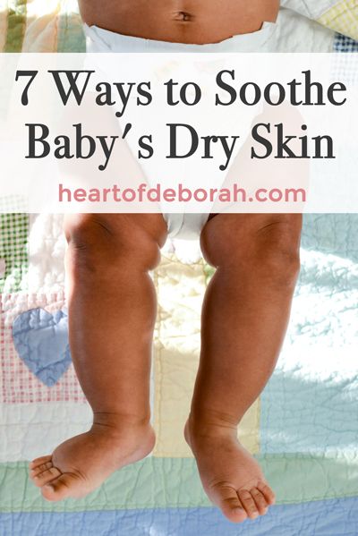 7 ways to soothe your baby's dry skin this winter. Is your baby suffering from dry skin? Try this! Baby Skin Care Tips, Newborn Skin Peeling, Newborn Dry Skin, Dry Peeling Skin, Baby Dry Skin, Baby Skin Care Products, Baby Play Ideas, Baby Moisturizer, Toys For Infants