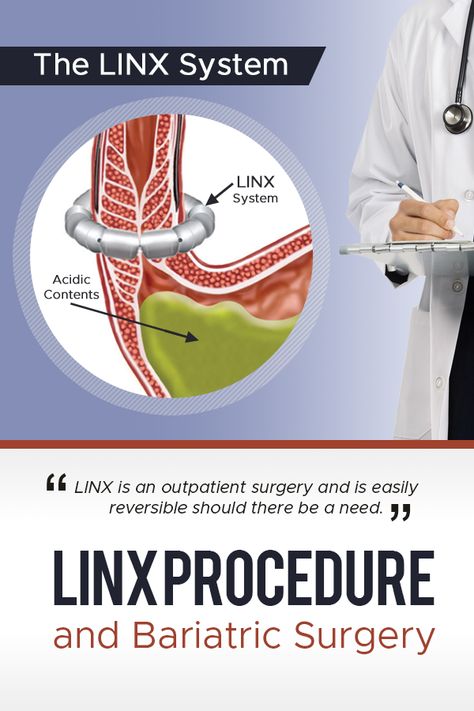 Do you have GERD after having a Vertical Sleeve Gastrectomy? Dr. Richard Gordon of Advanced Surgical Associates of West Florida explains the options to treat GERD and discusses the results of a study about it! #vsg #bariatricsurgery #GERD #verticalsleeve #wls #weightlosssurgery #LINX Vertical Sleeve Gastrectomy, Gerd Symptoms, Gastric Problem, Post Sleeve, Sleeve Gastrectomy, Reflux Symptoms, Reflux Disease, Medication Management, Gastric Bypass