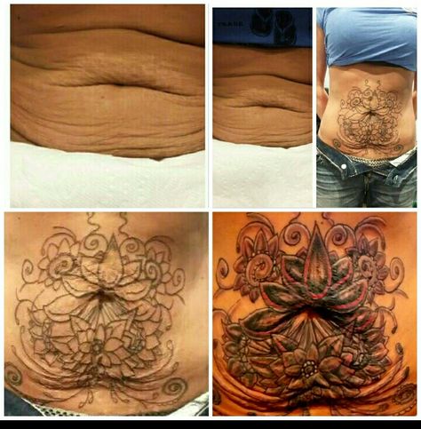 Stomach Tattoos To Cover Loose Skin, Tattoos Stomach, Tattoo Makeup Coverup, Scars Tattoo, Stretch Mark Tattoo, Button Tattoo, Stomach Tattoo, Yoga Photoshoot, Belly Tattoo