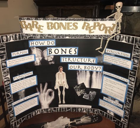 How do bones structure the human body? 1st grade science fair project idea for skeletal system or human bones Skeletal System Project Ideas, Human Body Science Fair Projects, Human Anatomy Science Fair Projects, Skeletal System Project Models, Anatomy Science Fair Projects, Skeletal System Project High School, Skeletal System Science Project, Skeleton Science Project, Muscular System Project